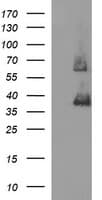 SCAMP2 Antibody (clone OTI2H2)