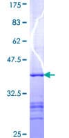Human Paraplegin / SPG7 Protein (Recombinant GST, N-terminus)