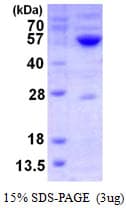 Human GATM / AGAT Protein (Recombinant His)