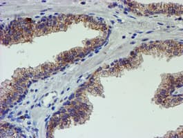 PDSS2 / DLP1 Antibody (clone OTI1C11)