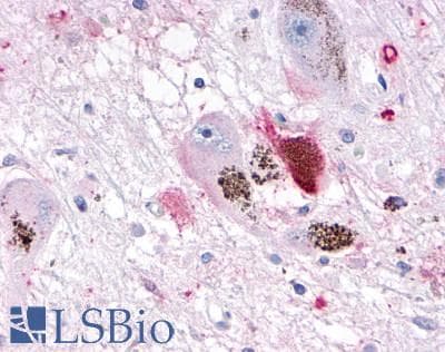 PathPlus™ OR10R2 Antibody (Extracellular Domain)