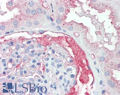 IHC-plus™ TTR / Transthyretin Antibody