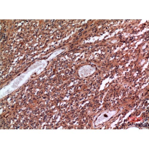 MME / CD10 Antibody (491-540 aa, Internal)
