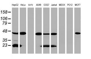 SCAD / ACADS Antibody (aa34-260, clone OTI1D2, Carrier-free)