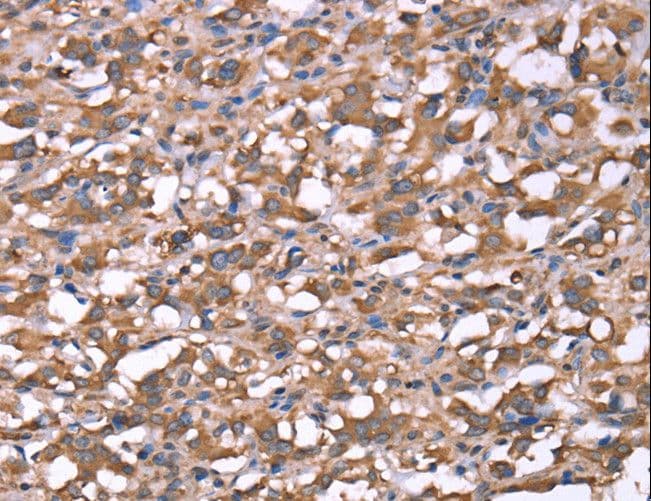 Polyclonal Rabbit anti-Human Spastin Antibody (IHC)