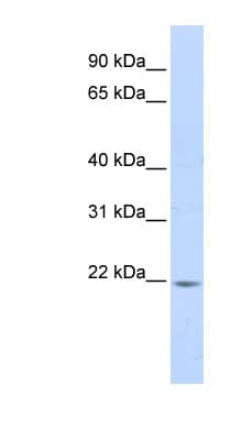 PPIB / Cyclophilin B Antibody (aa36-85)