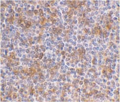 Polyclonal Rabbit anti-Human APOBEC3G / CEM15 Antibody (IHC, WB)