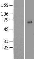 FOXO1 / FKHR Protein (Over-Expression Lysate Myc-DDK (Flag))