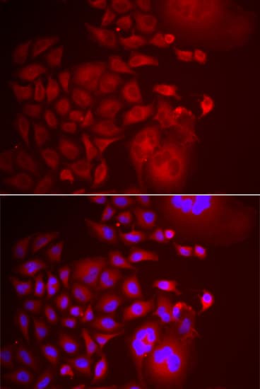 TMEM1 / TRAPPC10 Antibody