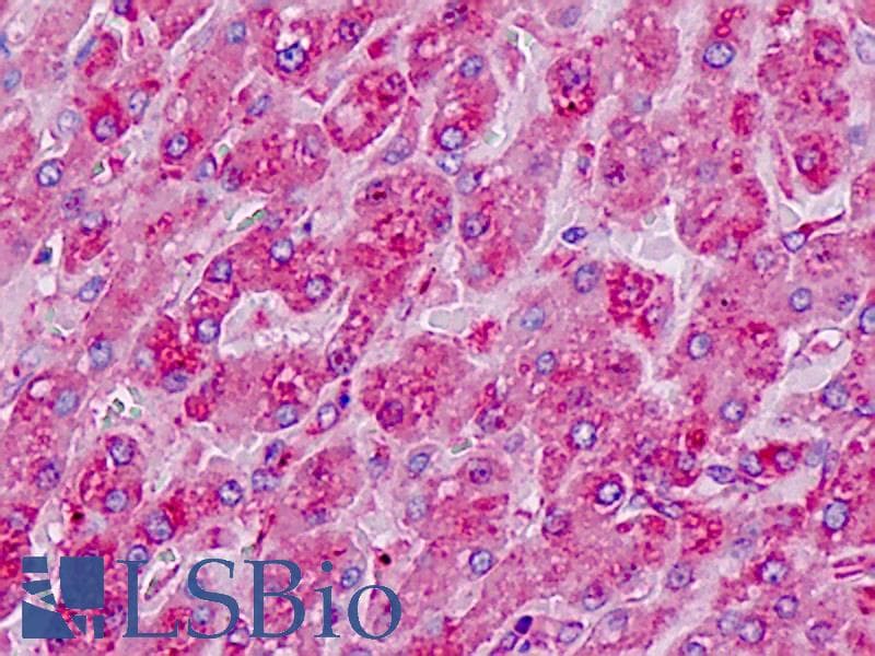 IHC-plus™ RPL7 / Ribosomal Protein L7 Antibody (aa199-248)