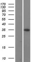 CCNB1IP1 Protein (Over-Expression Lysate Myc-DDK (Flag))