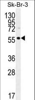 Polyclonal Rabbit anti-Human TRABD2A / C2orf89 Antibody (aa342-371, WB)