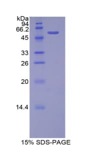 Rat BACE2 Protein (Recombinant His-GST)