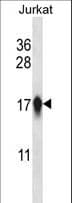 Polyclonal Rabbit anti-Human CENPA / CENP-A Antibody (aa82-110, WB)