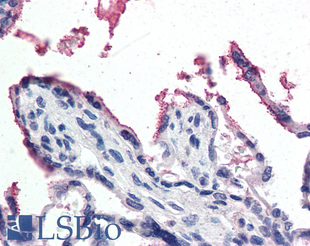 IHC-plus™ GPX3 Antibody (aa102-114)