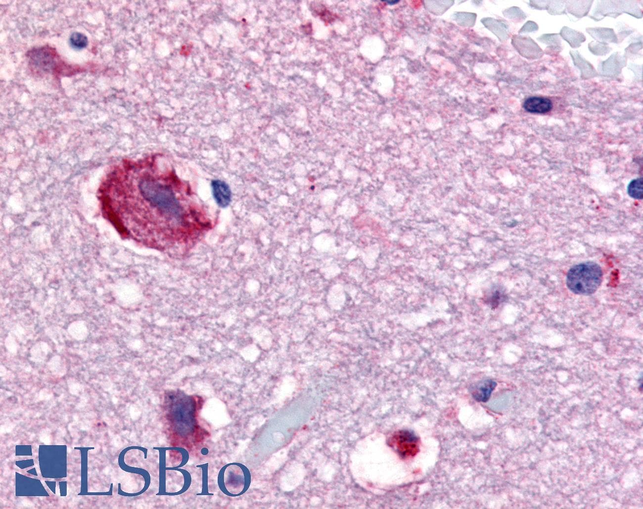 IHC-plus™ GPR61 Antibody (Cytoplasmic Domain)