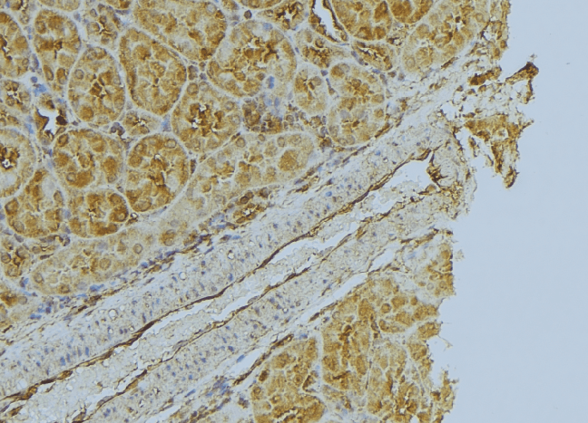 Polyclonal Rabbit anti-Human FLOT1 / Flotillin 1 Antibody (IHC, WB)