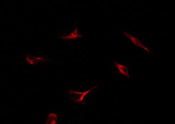 ER Alpha / Estrogen Receptor Antibody