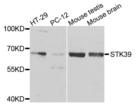 STK39 / SPAK Antibody
