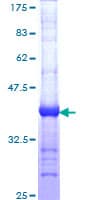 Human Dystonin / BPAG1 Protein (Recombinant GST, N-terminus)