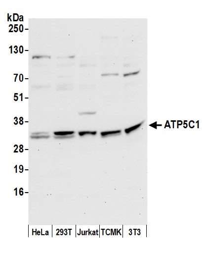 ATP5C1 Antibody (aa175-225)