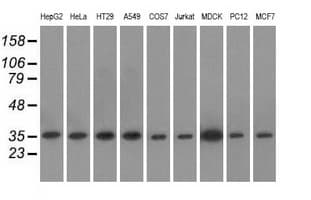 Monoclonal Mouse anti-Human EIF2S1 Antibody (clone OTI3H7, WB)
