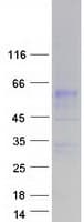 Human SLC34A3 / NaPi-2c Protein (Recombinant Myc-DDK (Flag))