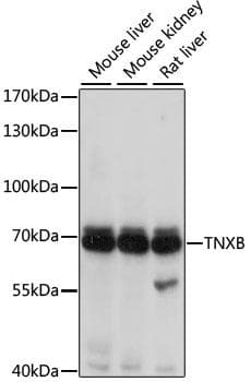TNXB / Tenascin XB Antibody