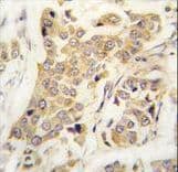 Polyclonal Rabbit anti-Human CDH8 / Cadherin 8 Antibody (aa33-63, IHC, WB)