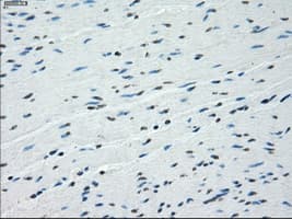 BUB1B / BubR1 Antibody (clone OTI3D9)