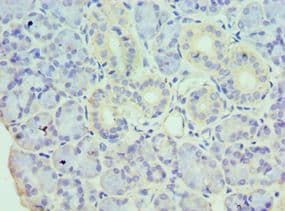 Polyclonal Rabbit anti-Human HDAC8 Antibody (aa1-377, IHC, WB)