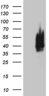 CDX1 Antibody (clone OTI3A1)