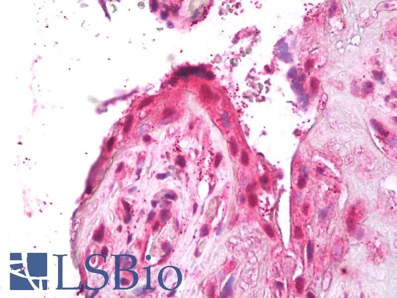 IHC-plus™ ACTRIIB / ACVR2B Antibody (aa1-30)