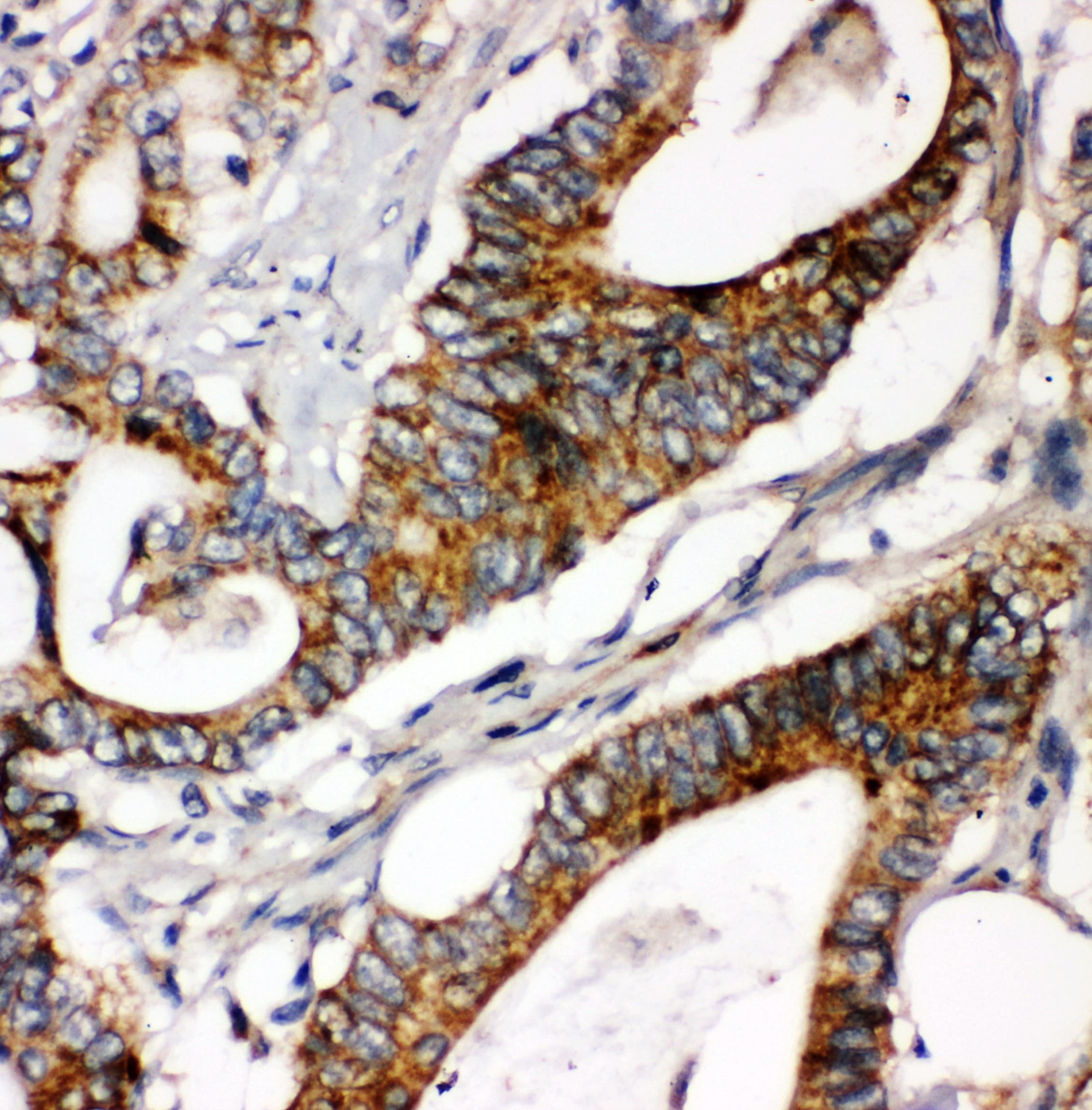 LAMC1 / Laminin Gamma 1 Antibody (aa1566-1579)