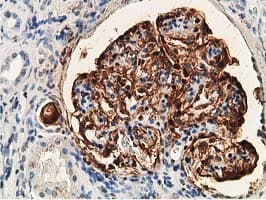 PDLIM2 / SLIM Antibody (clone OTI11A12)