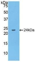 IL-10 Antibody (aa19-178)