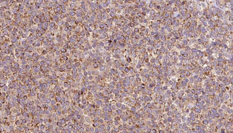 ACO2 / Aconitase 2 Antibody