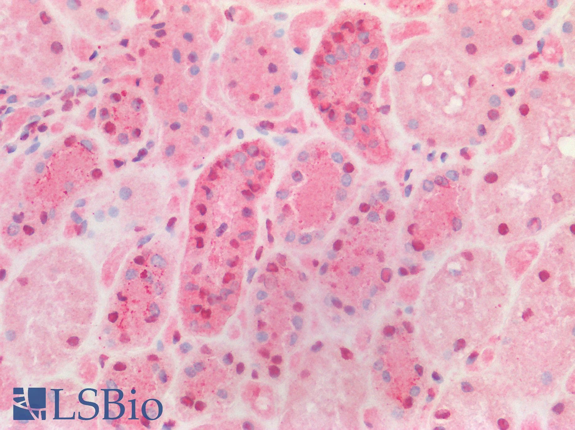 AATF Antibody (aa171-220)