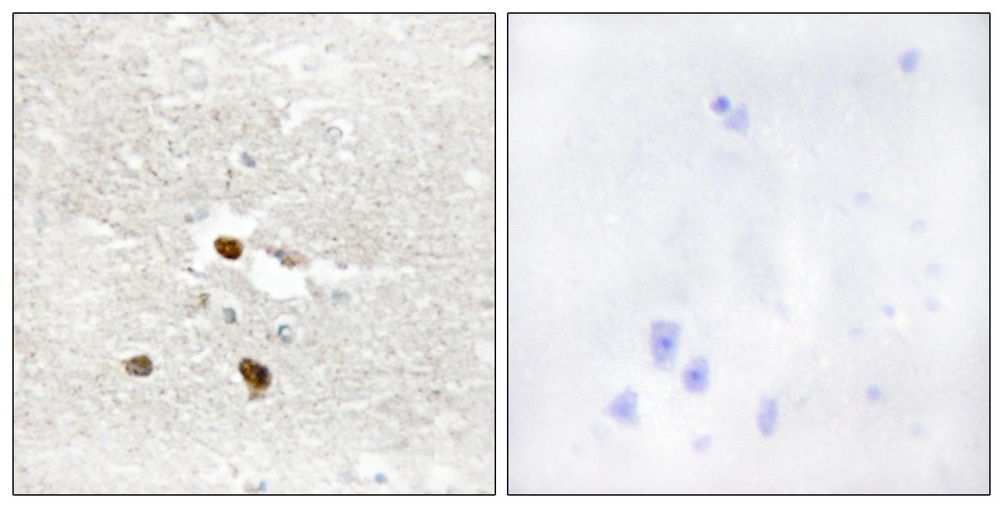 ZNF287 Antibody