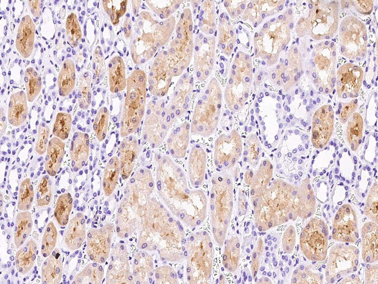 Polyclonal Rabbit anti-Human CRYM Antibody (IHC, WB)