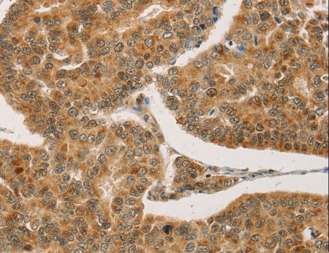 CPA2 Antibody