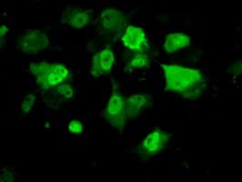 PME-1 / PPME1 Antibody (clone OTI6H5)