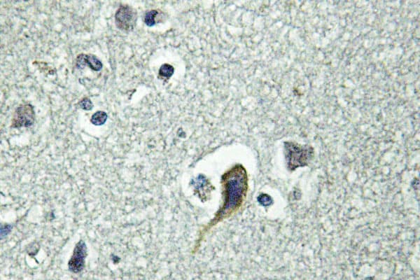 Polyclonal Rabbit anti-Human PTH / Parathyroid Hormone Antibody (Leu187, IHC, IF, WB)