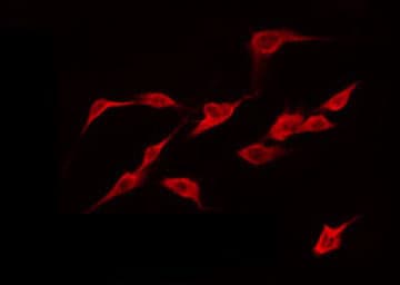 CAPN12 / Calpain 12 Antibody