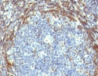 BCL2 / Bcl-2 Antibody (clone BCL2/782, Ready-to-Use)