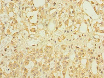 FILIP1L Antibody