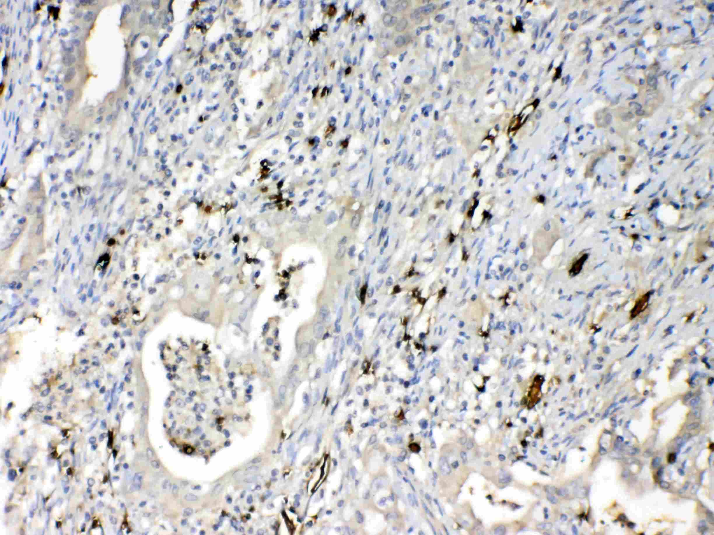 HBD / Hemoglobin Delta Antibody