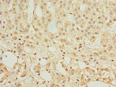 HEMK1 Antibody