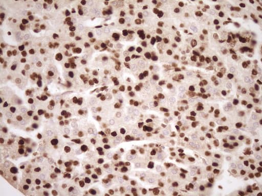 SAE1 Antibody (clone OTI6C7)