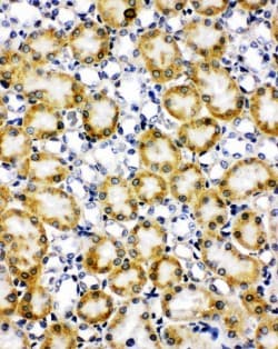 Polyclonal Rabbit anti-Human PXN / Paxillin Antibody (aa456-472, IHC, WB)